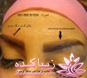 هاشورابرودرمشهد